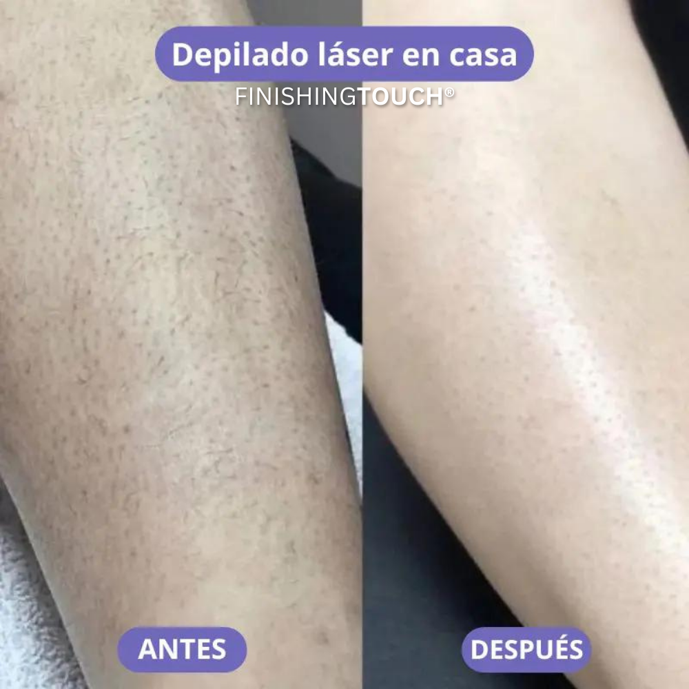 Depiladora Luzéa — Piel Suave Sin Irritación